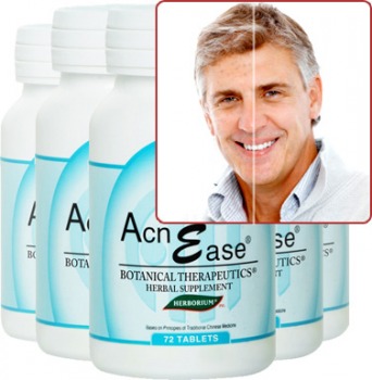 Causes and Treatment for Male Hormonal Acne